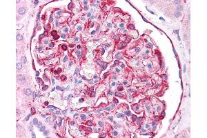 Vimentin antibody was used for immunohistochemistry at a concentration of 4-8 ug/ml. (Vimentin anticorps  (C-Term))
