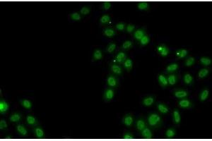 Immunofluorescence analysis of MCF7 cells using SOX5 Polyclonal Antibody