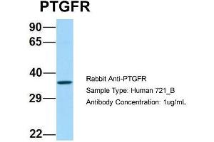 Host: Rabbit Target Name: PTGFR Sample Type: Human 721_B Antibody Dilution: 1. (PTGFR anticorps  (C-Term))