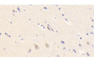 Detection of NTRK3 in Human Cerebellum Tissue using Polyclonal Antibody to Neurotrophic Tyrosine Kinase Receptor Type 3 (NTRK3)