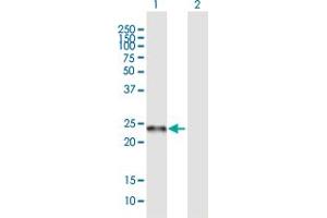 Western Blot analysis of C19orf50 expression in transfected 293T cell line ( H00079036-T01 ) by C19orf50 MaxPab polyclonal antibody. (C19orf50 anticorps  (AA 1-176))
