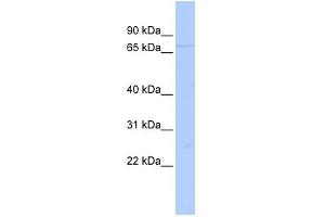 WB Suggested Anti-DDX59 Antibody Titration:  0. (DDX59 anticorps  (Middle Region))