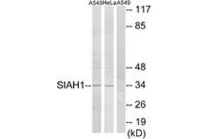 Western blot analysis of extracts from A549/HeLa cells, using SIAH1 Antibody. (SIAH1 anticorps  (AA 181-230))