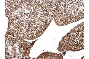 IHC-P Image B-Raf antibody [N2C1], Internal detects B-Raf protein at cytosol on mouse testis by immunohistochemical analysis.