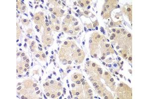 Immunohistochemistry of paraffin-embedded Human gastric using CHEK1 Polyclonal Antibody at dilution of 1:100 (40x lens). (CHEK1 anticorps)