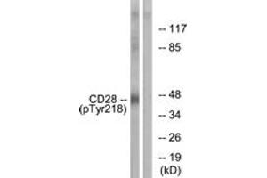 Western blot analysis of extracts from HepG2 cells treated with nocodazole 1ug/ml 16h, using CD28 (Phospho-Tyr218) Antibody. (CD28 anticorps  (pTyr218))