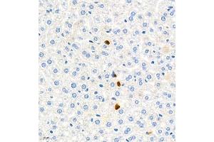 Immunohistochemistry of paraffin embedded mouse liver using ly6g (ABIN7074524) at dilution of 1:1000 (400x lens) (Ly6g anticorps)