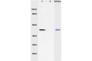 L1 mouse brain lysates L2 human colon carcinoma lysates probed with Anti CD46/MCP Polyclonal Antibody, Unconjugated (ABIN687832) at 1:200 in 4 °C.