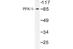 Image no. 2 for anti-Phosphofructokinase, Liver (PFKL) antibody (ABIN272176) (PFKL anticorps)
