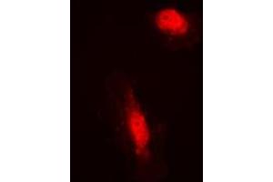 Immunofluorescent analysis of COPS3 staining in HeLa cells. (COPS3 anticorps  (Center))