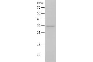 Interleukin 15 (IL15) (AA 49-162) protein (His-IF2DI Tag)
