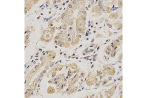 Immunohistochemistry of paraffin-embedded human stomach using SERPINF1 antibody at dilution of 1:200 (x400 lens). (PEDF anticorps)