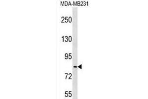LRRC70 Antibody (C-term) (ABIN1537455 and ABIN2850345) western blot analysis in MDA-M cell line lysates (35 μg/lane). (LRRC70 anticorps  (C-Term))