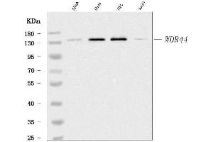 Western blot analysis of WDR44 using anti-WDR44 antibody (ABIN7600394). (WDR44 anticorps  (AA 188-913))