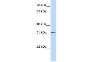 WB Suggested Anti-RHOXF2 Antibody Titration:  0.