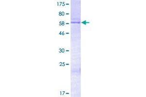 Image no. 1 for Homeobox D13 (HOXD13) (AA 1-343) protein (GST tag) (ABIN1307006)