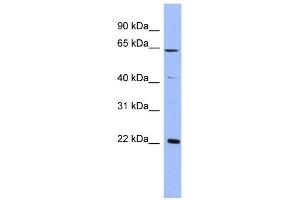 WB Suggested Anti-FREQ Antibody Titration:  0. (NCS1 anticorps  (Middle Region))