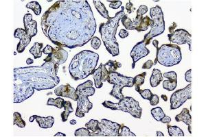 IHC analysis of NMI using anti-NMI antibody (ABIN3043451). (NMI anticorps  (AA 2-307))