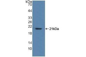 Detection of Recombinant MYL2, Human using Polyclonal Antibody to Myosin Light Chain 2 (MYL2)
