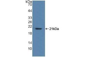 Detection of Recombinant MYL2, Human using Polyclonal Antibody to Myosin Light Chain 2 (MYL2) (MYL2 anticorps  (AA 2-159))