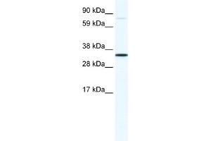WB Suggested Anti-MSX1 Antibody Titration:  1. (MSX1 anticorps  (N-Term))