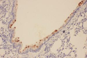Anti-SOX2 antibody, IHC(P) IHC(P): Rat Lung Tissue (SOX2 anticorps  (Middle Region))