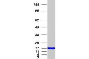 Validation with Western Blot
