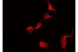 ABIN6275338 staining Hela by IF/ICC. (PDRG1 anticorps  (Internal Region))