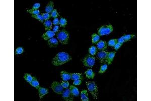 IF analysis of CYP27A1 using anti-CYP27A1 antibody (ABIN7602336).