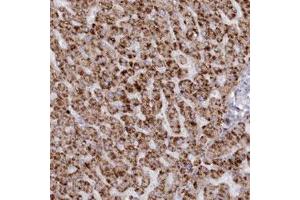 Immunohistochemical staining (Formalin-fixed paraffin-embedded sections) of human liver with ARSB polyclonal antibody  shows strong cytoplasmic positivity in hepatocytes. (Arylsulfatase B anticorps)
