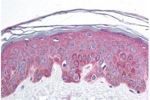 Human Skin (formalin-fixed, paraffin-embedded) stained with BRD7 antibody ABIN214730 at 10 ug/ml followed by biotinylated goat anti-rabbit IgG secondary antibody ABIN481713, alkaline phosphatase-streptavidin and chromogen. (BRD7 anticorps  (C-Term))
