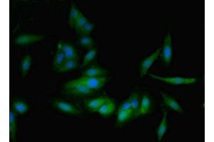 Immunofluorescent analysis of Hela cells using ABIN7164874 at dilution of 1:100 and Alexa Fluor 488-congugated AffiniPure Goat Anti-Rabbit IgG(H+L)
