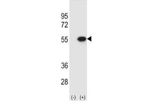 Western blot analysis of Reptin antibody and 293 cell lysate (2 ug/lane) either nontransfected (Lane 1) or transiently transfected (2) with the RUVBL2 gene.