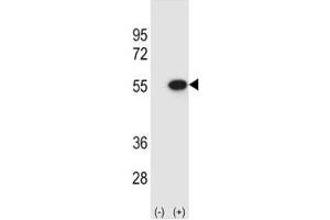 Western blot analysis of Reptin antibody and 293 cell lysate (2 ug/lane) either nontransfected (Lane 1) or transiently transfected (2) with the RUVBL2 gene. (RUVBL2 anticorps  (AA 400-430))