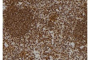 ABIN6269102 at 1/100 staining Mouse spleen tissue by IHC-P.