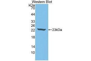 Detection of Recombinant IL18, Rabbit using Polyclonal Antibody to Interleukin 18 (IL18) (IL-18 anticorps  (AA 32-192))