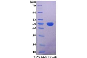 SDS-PAGE of Protein Standard from the Kit (Highly purified E. (Aconitase 1 Kit ELISA)