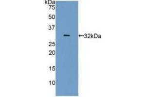 Detection of Recombinant CA4, Human using Polyclonal Antibody to Carbonic Anhydrase IV (CA4)
