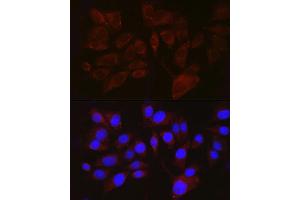 Immunofluorescence analysis of  cells using PMEL Rabbit pAb (ABIN7269510) at dilution of 1:100 (40x lens).