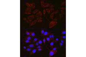 Immunofluorescence analysis of  cells using PMEL Rabbit pAb (ABIN7269510) at dilution of 1:100 (40x lens). (Melanoma gp100 anticorps  (AA 25-300))