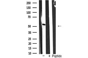 Western blot analysis of TR expression in PC12 cells