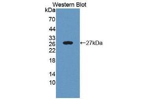 Western blot analysis of the recombinant protein. (VAV1 anticorps  (AA 565-795))
