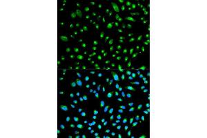 Immunofluorescence analysis of HeLa cell using WT1 antibody. (WT1 anticorps  (AA 1-302))