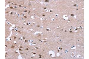 The image on the left is immunohistochemistry of paraffin-embedded Human brain tissue using ABIN7190847(GPR171 Antibody) at dilution 1/25, on the right is treated with synthetic peptide. (GPR171 anticorps)