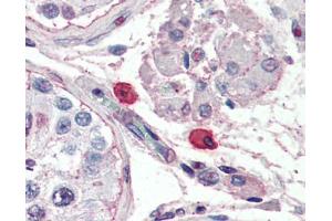 anti-Fc epsilon Receptor 1 antibody