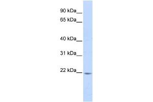 WB Suggested Anti-PPIB Antibody Titration:  0. (PPIB anticorps  (N-Term))