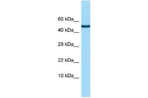 WB Suggested Anti-CHRDL2 Antibody Titration: 1. (CHRDL2 anticorps  (N-Term))