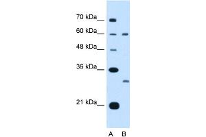 WB Suggested Anti-TSPAN32 Antibody Titration:  5. (TSPAN32 anticorps  (Middle Region))