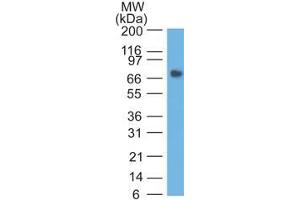 Western Blot analysis of human Stomach lysate using CEA Mouse Monoclonal Antibody (COL-1). (CEACAM5 anticorps)