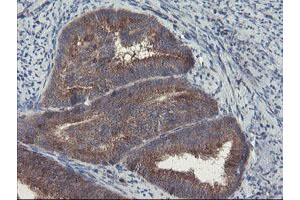 Image no. 7 for anti-Prefoldin Subunit 3 (PFDN3) antibody (ABIN1501705)